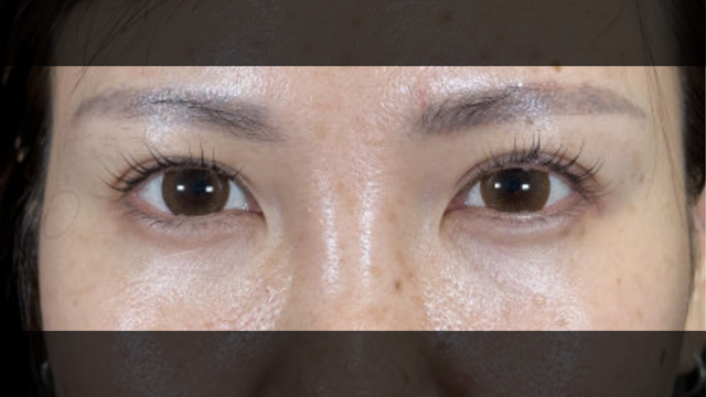 Postoperative Condition Part 1