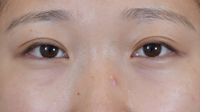 Postoperative Condition Part 1