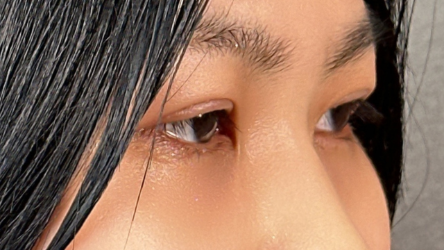 Postoperative Condition Part 1