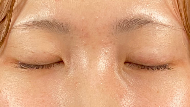 Postoperative Condition Part 1