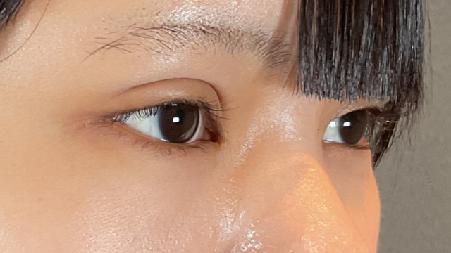 Postoperative Condition Part 1