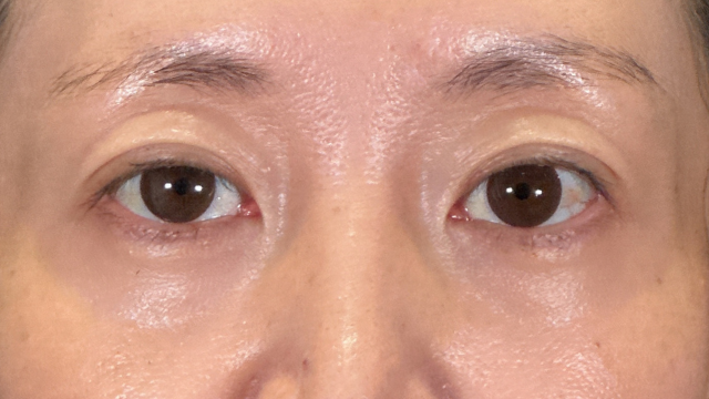 Postoperative Condition Part 1