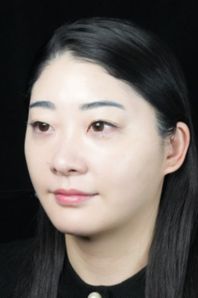 手術前の状態 その1