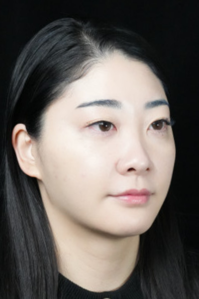 手術前の状態 その1