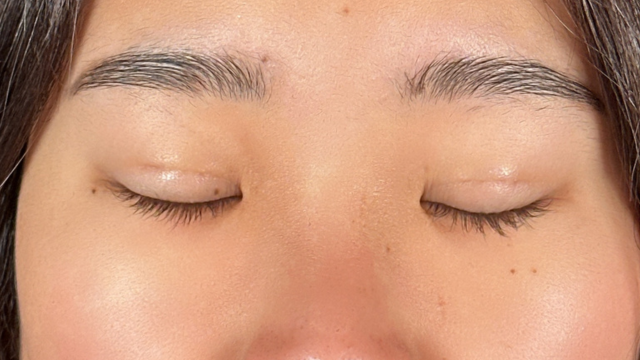 Postoperative Condition Part 1