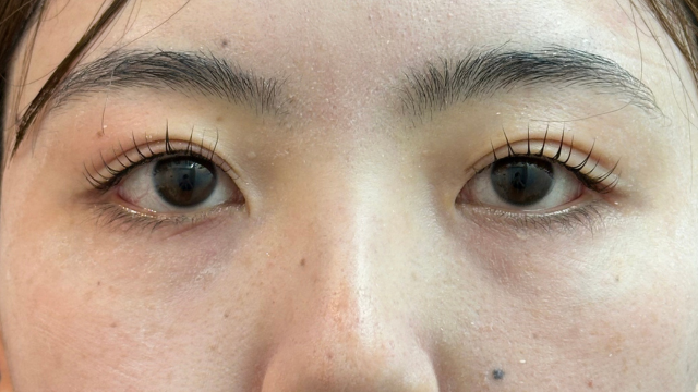 Postoperative Condition Part 1