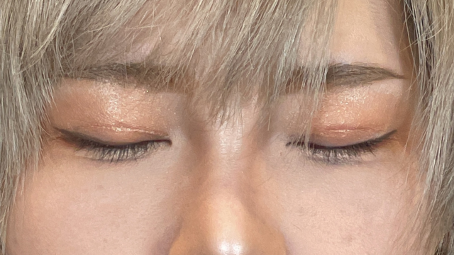 Postoperative Condition Part 1