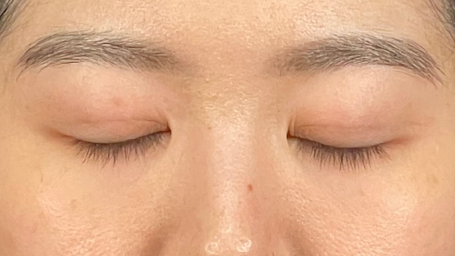 Postoperative Condition Part 1