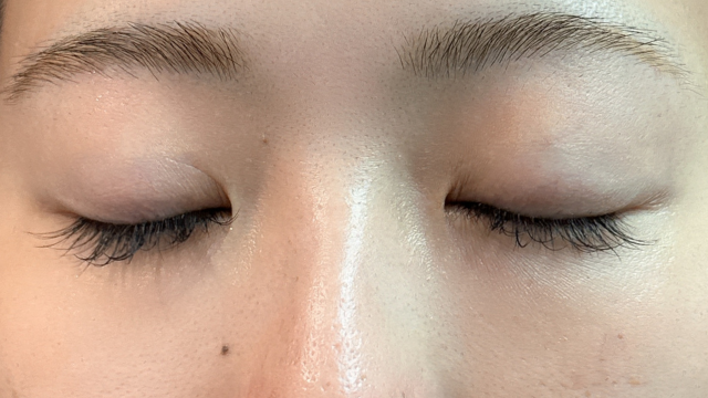 Postoperative Condition Part 1