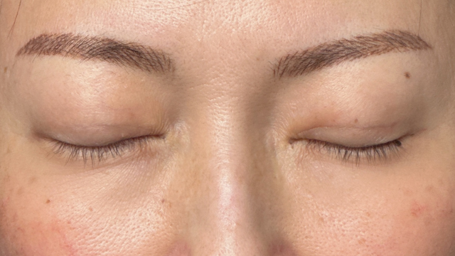 Postoperative Condition Part 1