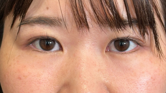 Postoperative Condition Part 1