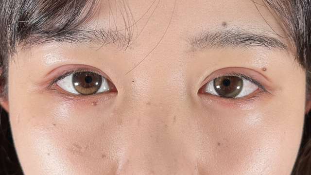 Postoperative Condition Part 1