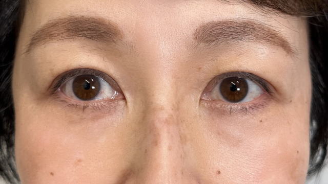 Postoperative Condition Part 1