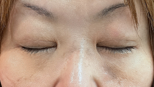 Postoperative Condition Part 1