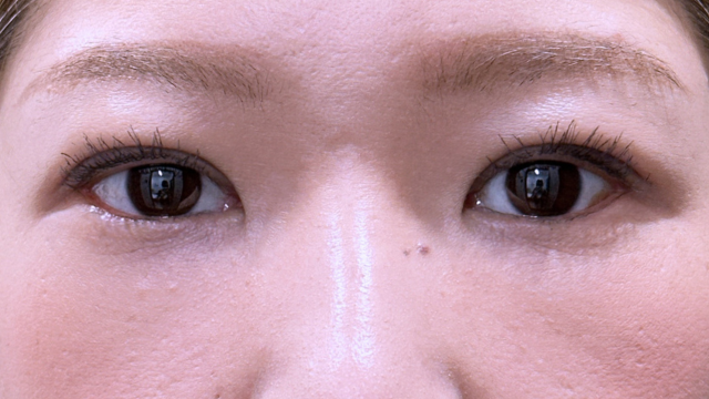 Postoperative Condition Part 1