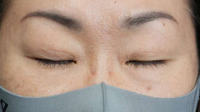 Postoperative Condition Part 1