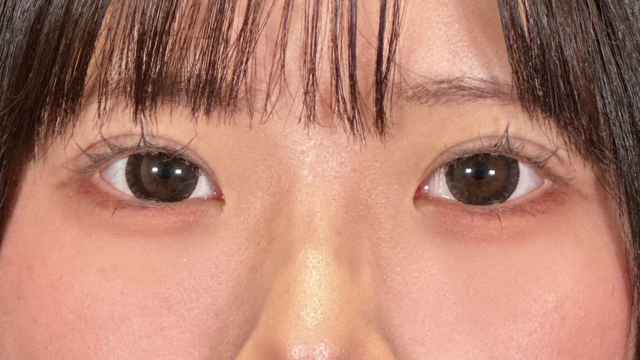 Postoperative Condition Part 1