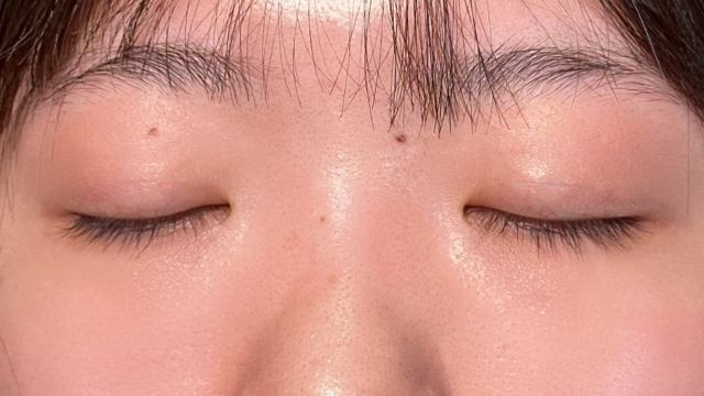 Postoperative Condition Part 1