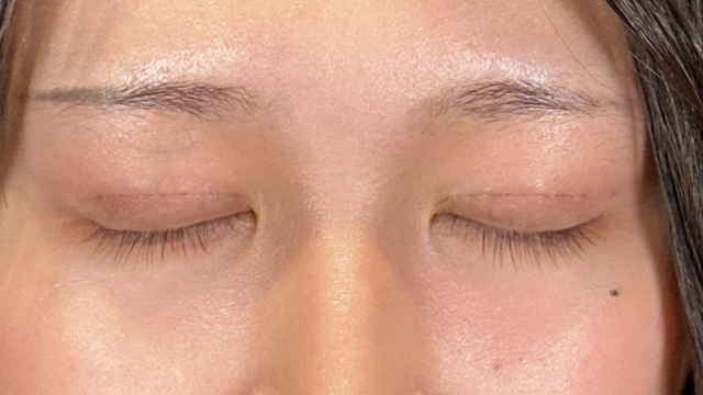 Postoperative Condition Part 1