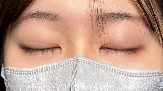 Postoperative Condition Part 1