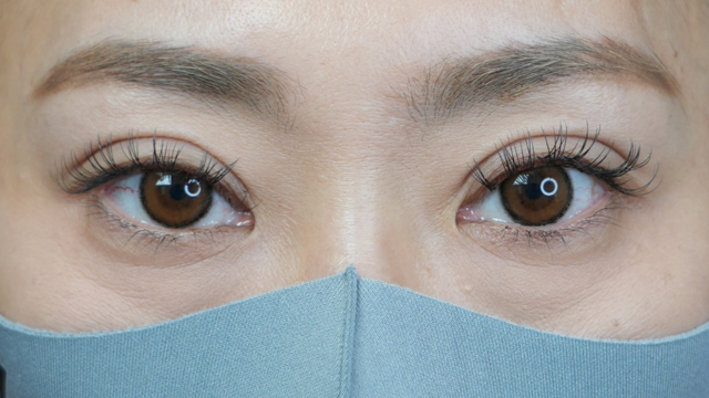 Postoperative Condition Part 1