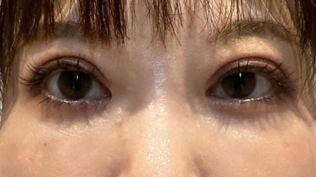 Postoperative Condition Part 1