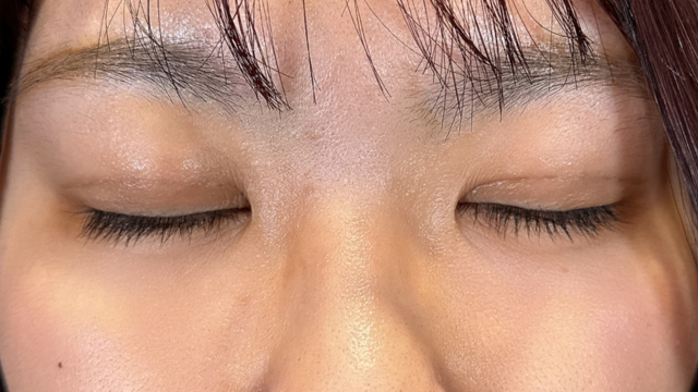 Postoperative Condition Part 1