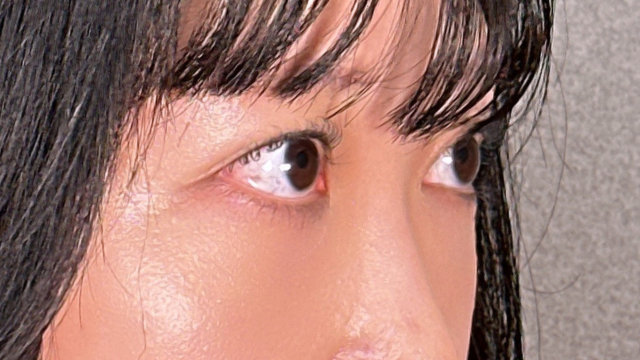 Postoperative Condition Part 1