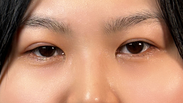 Postoperative Condition Part 1