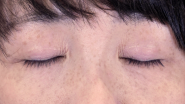 Postoperative Condition Part 1