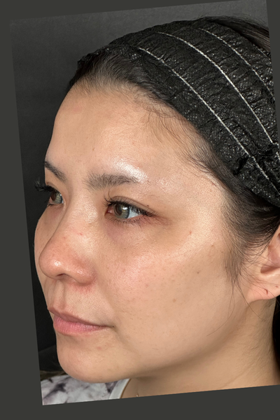 Postoperative Condition Part 1