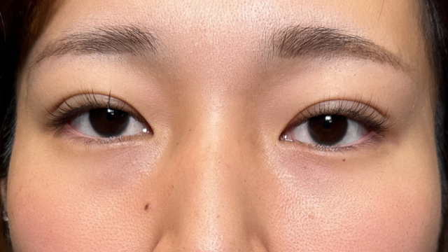 Postoperative Condition Part 1