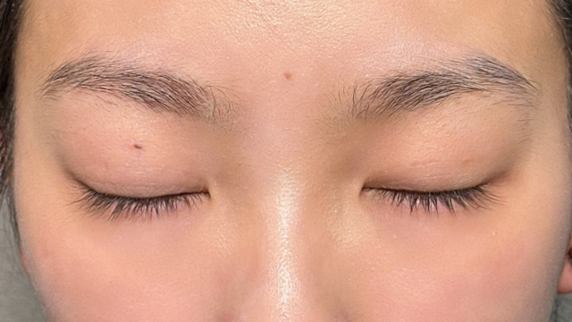 Postoperative Condition Part 1