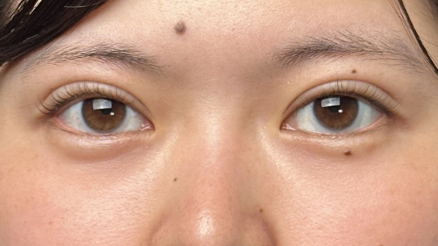 Postoperative Condition Part 1