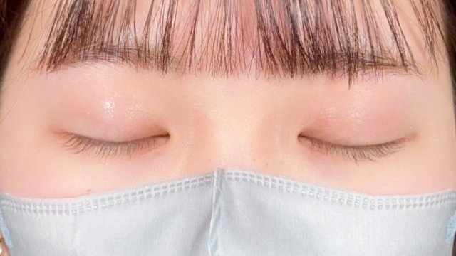 Postoperative Condition Part 1