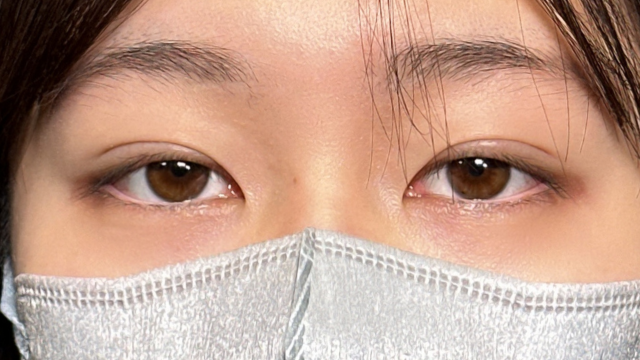 Postoperative Condition Part 1