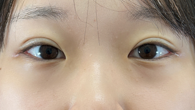 Postoperative Condition Part 1