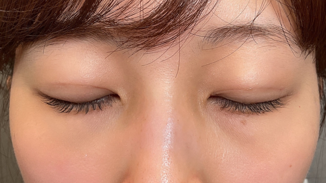 Postoperative Condition Part 1