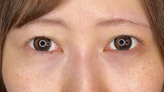 Postoperative Condition Part 1