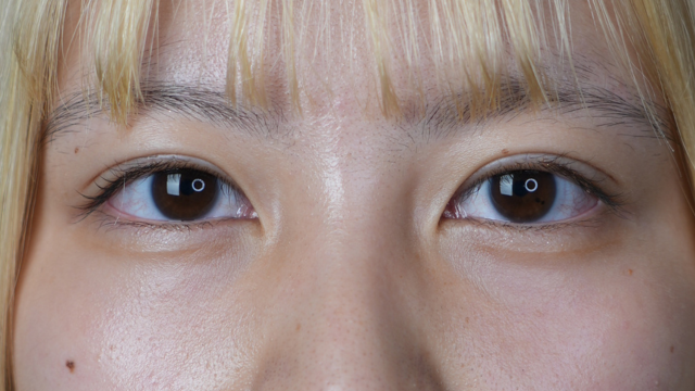 Postoperative Condition Part 1