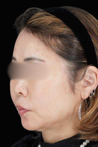 Postoperative Condition Part 1