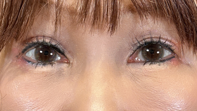 Postoperative Condition Part 1