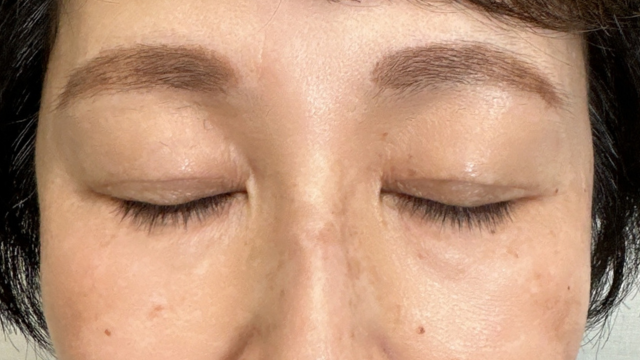 Postoperative Condition Part 1