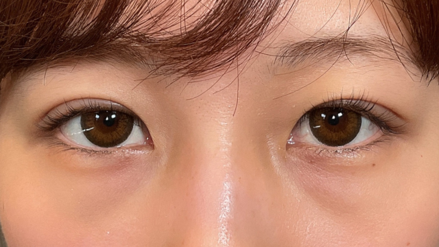 Postoperative Condition Part 1