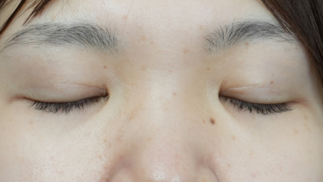 Postoperative Condition Part 1