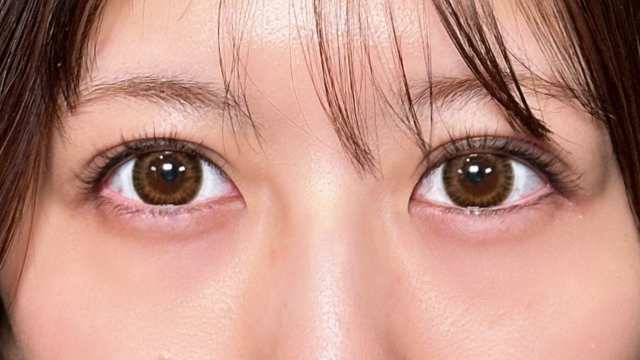 Postoperative Condition Part 1