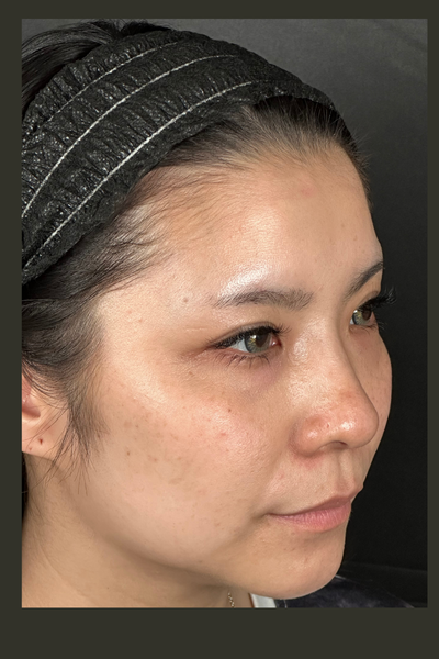 手術前の状態 その1