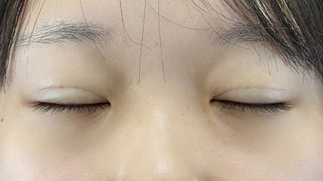 Postoperative Condition Part 1