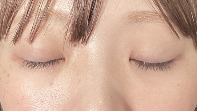 Postoperative Condition Part 1