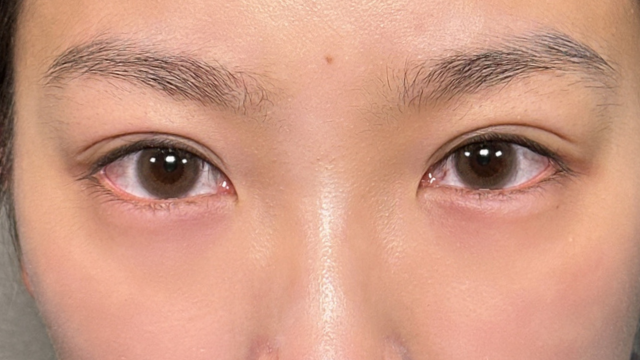 Postoperative Condition Part 1